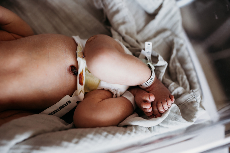 Fresh 48 Photography, a baby lays in blankets, freshly cut umbilical cord and hospital anklet identifier shown